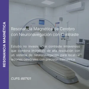 Resonancia magnética de cerebro con neuronavegación y contraste y precio en línea, centro aliado de MEI.