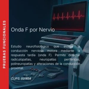 Onda F por nervio con precio en línea, centro de imagen aliado de MEI.