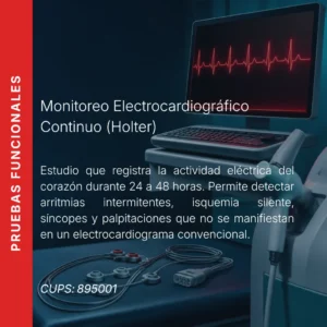 Monitoreo electrocardiográfico continuo (Holter) con precio en línea, centro de imagen aliado de MEI.