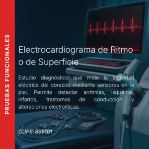 Electrocardiograma de ritmo o de superficie con precio en línea, centro de imagen aliado de MEI.