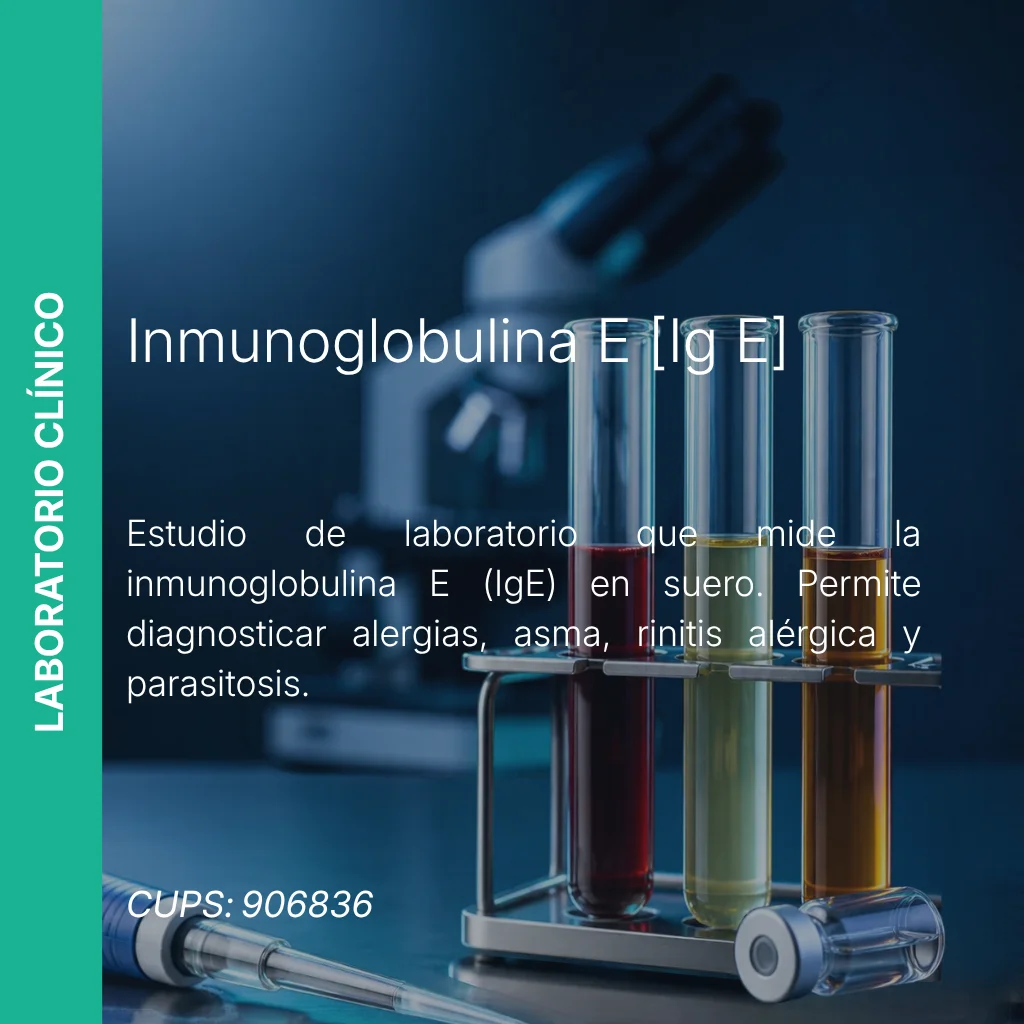 Inmunoglobulina E (IgE) - Precio MEI