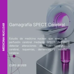 Gamagrafía SPECT cerebral con precio en línea, centro de imagen aliado de MEI.