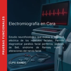 Electromiografía en cara con precio en línea, centro de imagen aliado de MEI.