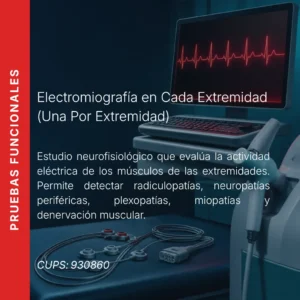 Electromiografía en cada extremidad (por cada extremidad) con precio en línea, centro aliado de MEI.
