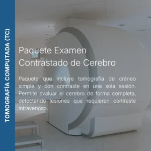 Paquete de examen contrastado de cerebro con precio en línea, centro de imagen aliado de MEI.